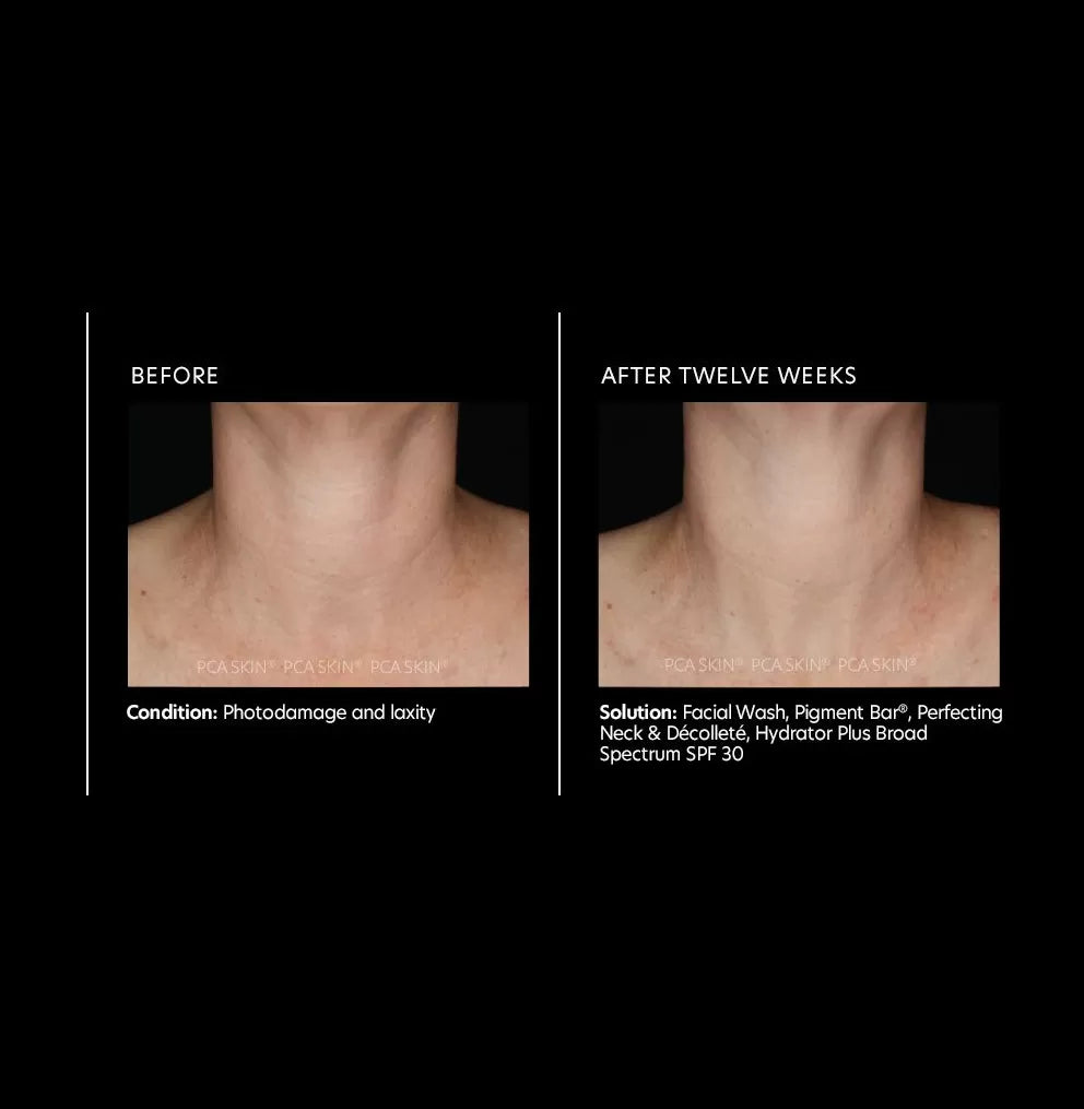 PCA Skin Perfecting Neck & Décolleté 85g