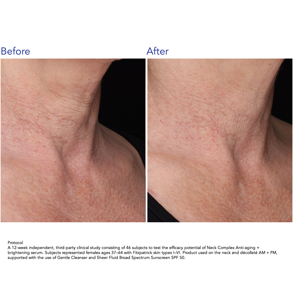 ZO Skin Health Neck Complex Anti-aging + Brightening Serum 50ml