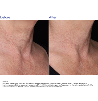 ZO Skin Health Neck Complex Anti-aging + Brightening Serum 50ml