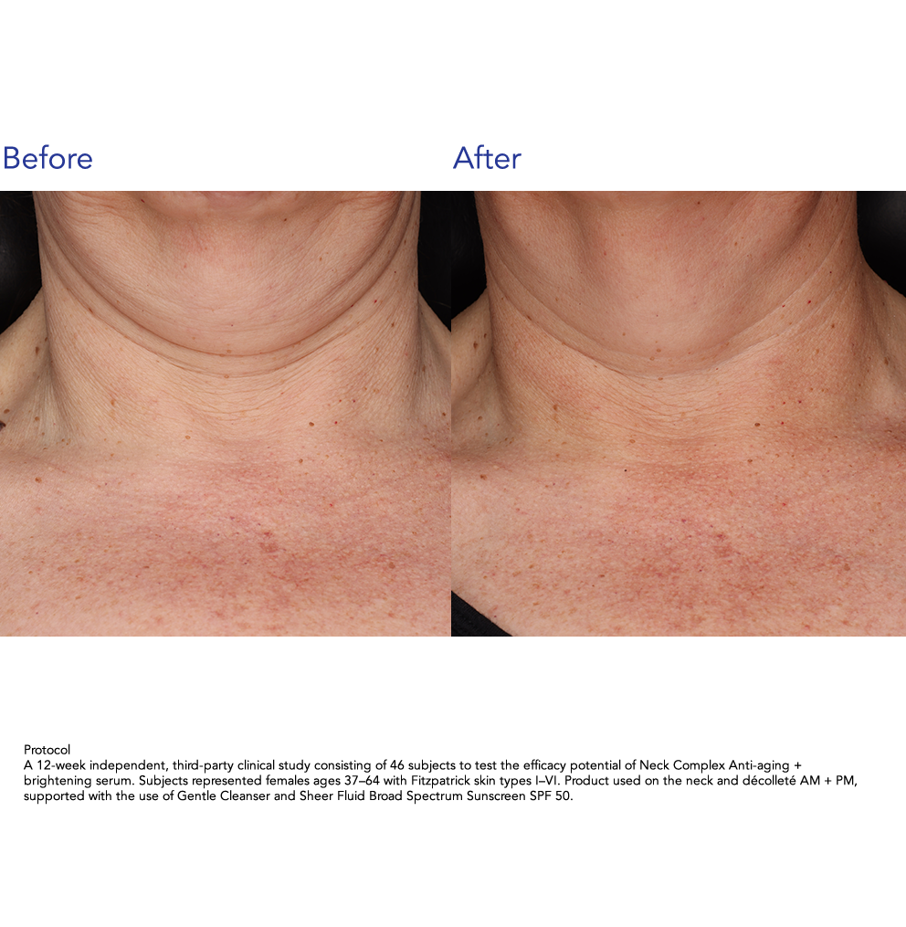 ZO Skin Health Neck Complex Anti-aging + Brightening Serum 50ml