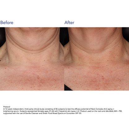 ZO Skin Health Neck Complex Anti-aging + Brightening Serum 50ml