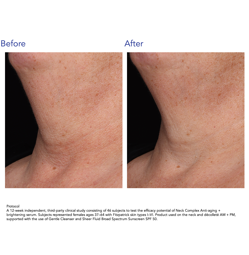 ZO Skin Health Neck Complex Anti-aging + Brightening Serum 50ml