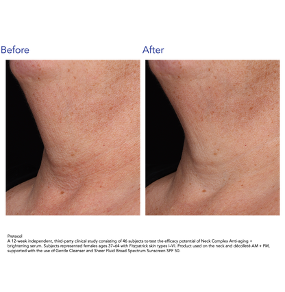 ZO Skin Health Neck Complex Anti-aging + Brightening Serum 50ml