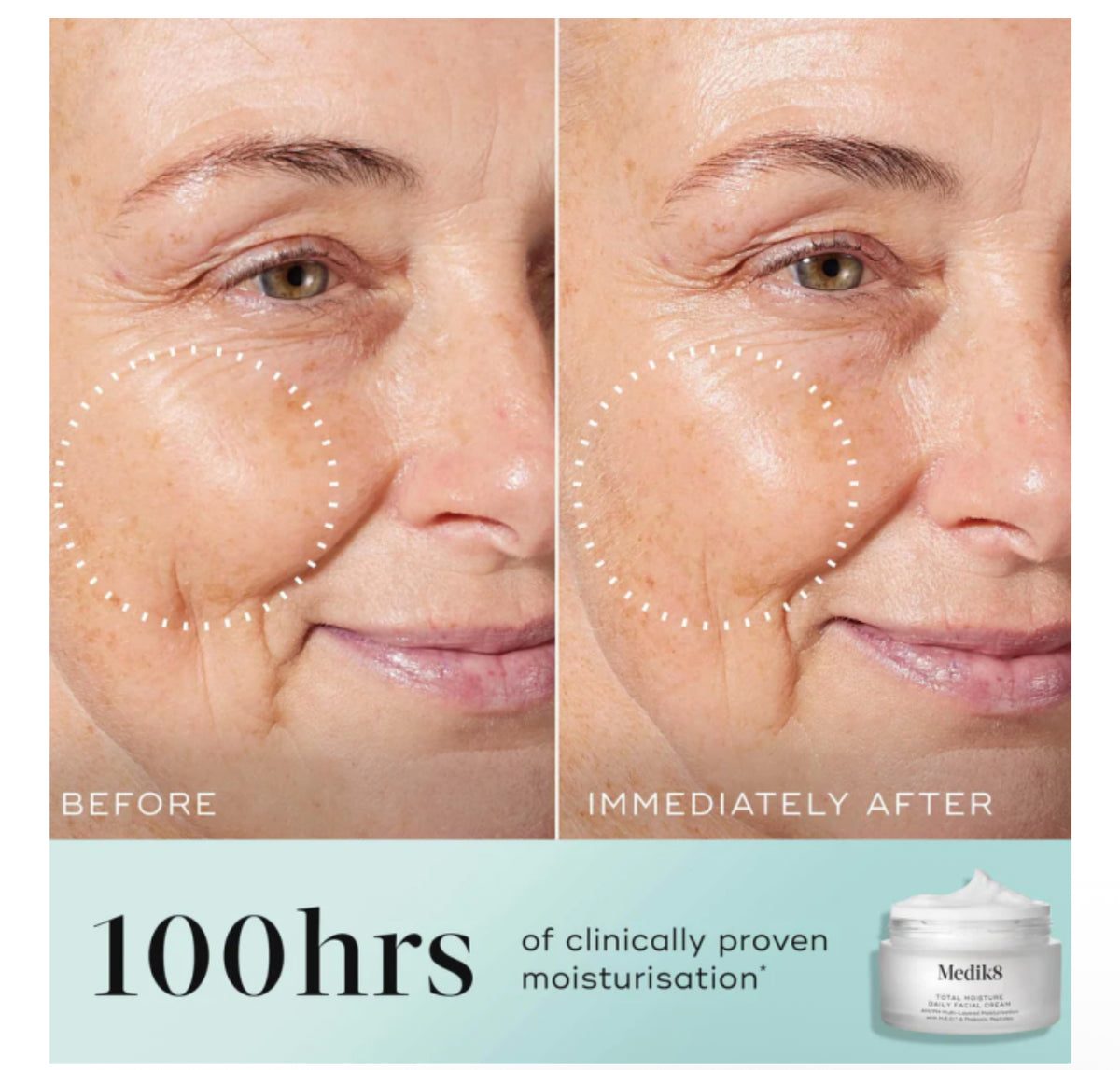 Medik8 Total Moisture Daily Facial Cream 50ml