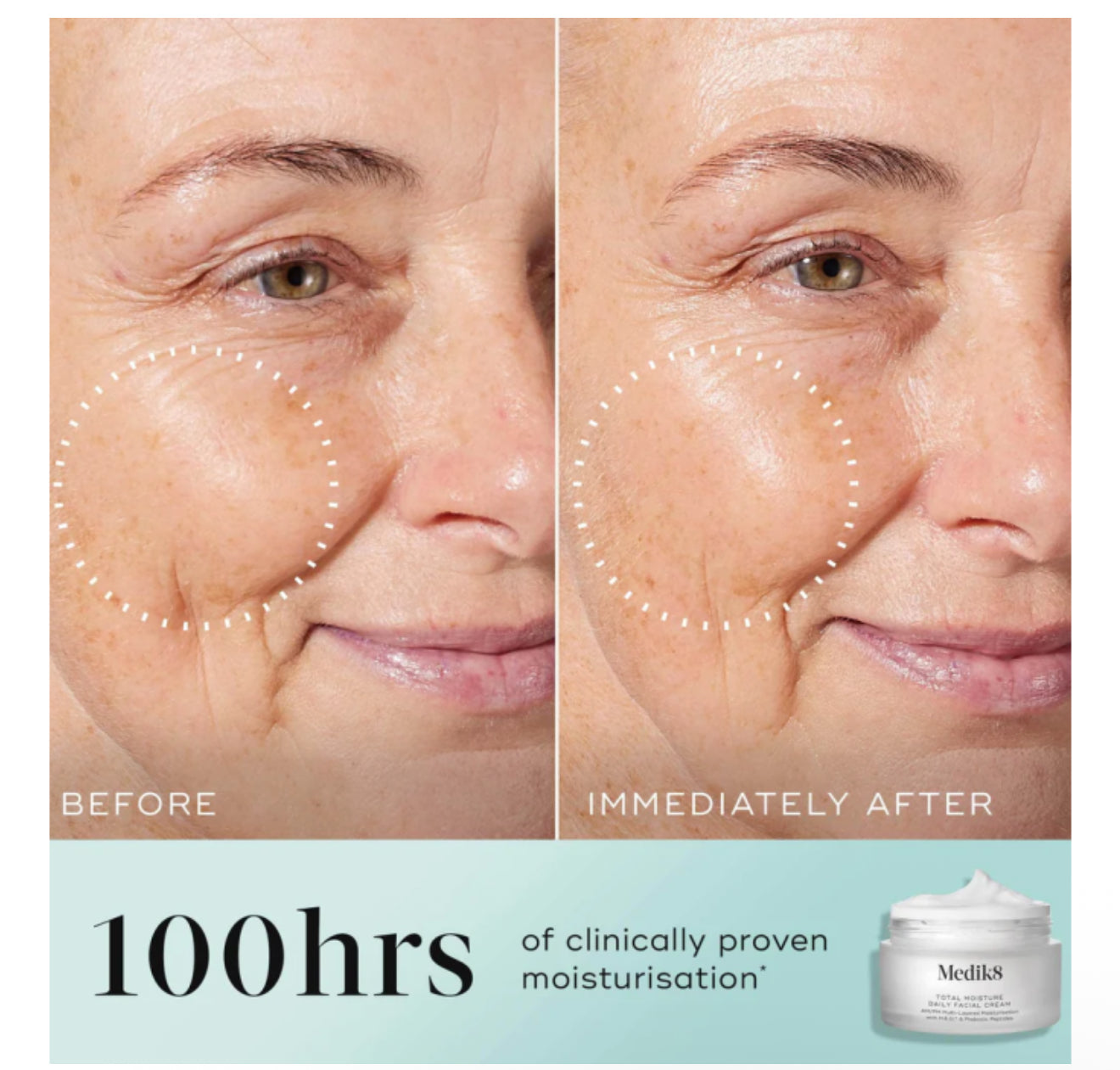 Medik8 Total Moisture Daily Facial Cream 50ml