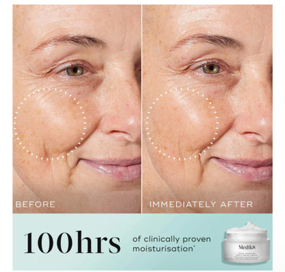 Medik8 Total Moisture Daily Facial Cream 50ml