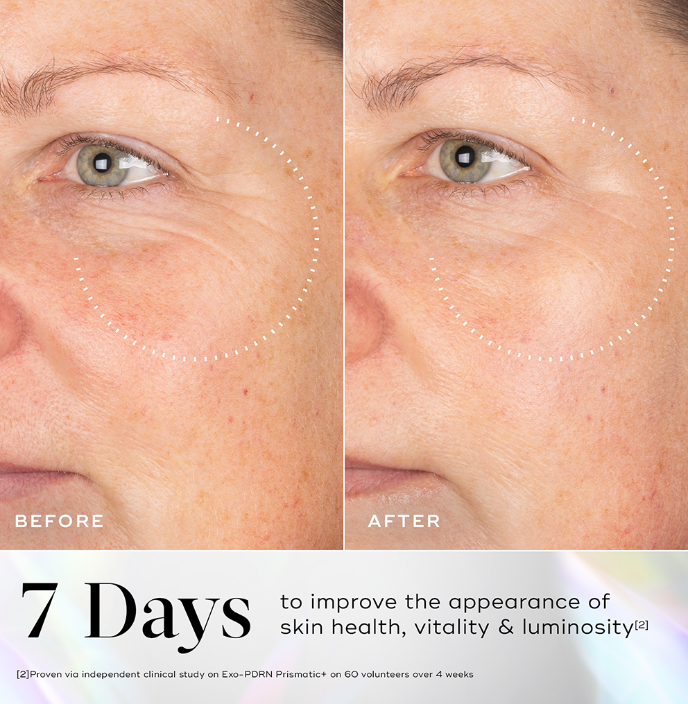 Medik8 Exo-PDRN Prismatic+ 30ml