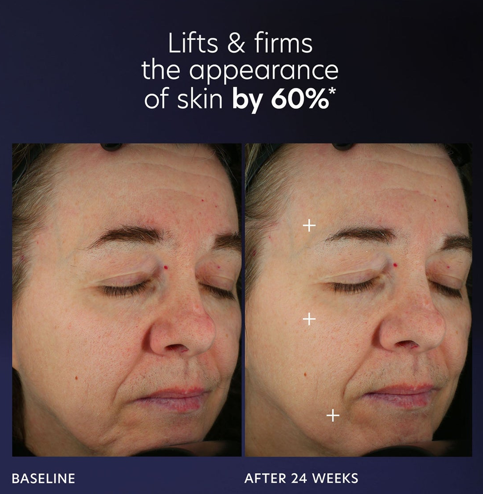 PCA Skin Pro-Max Age Renewal 30ml