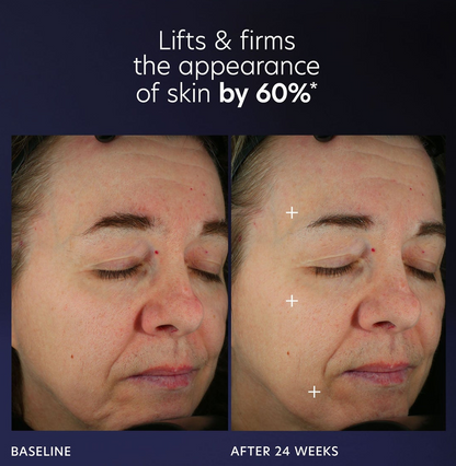 PCA Skin Pro-Max Age Renewal 30ml