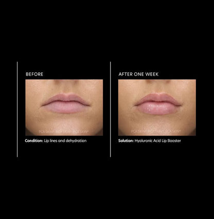 PCA Skin Hyaluronic Acid Lip Booster 6g