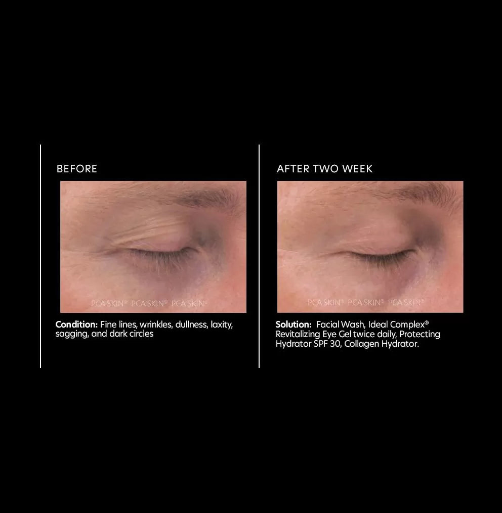 PCA Skin Ideal Complex Revitalizing Eye Gel 14g