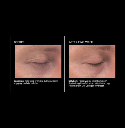 PCA Skin Ideal Complex Revitalizing Eye Gel 14g