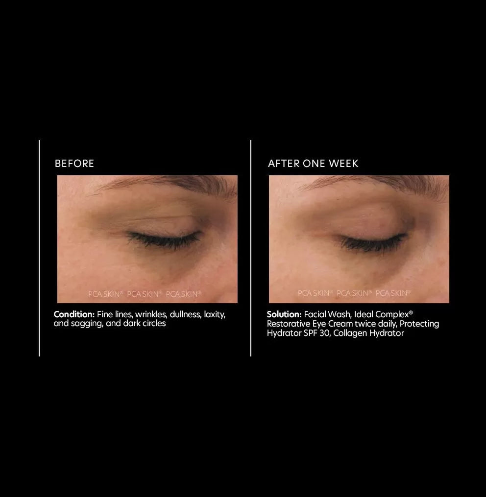 PCA Skin Ideal Complex Revitalizing Eye Gel 14g