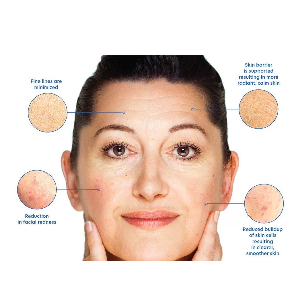 PCA Skin Resurfacing Serum (30 ml)