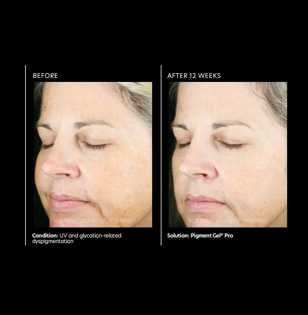 PCA Skin Pigment Gel Pro 29ml
