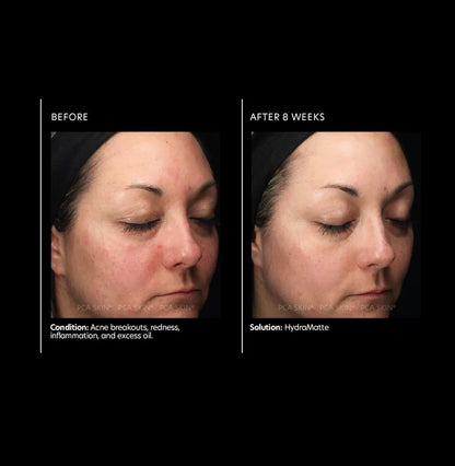 PCA Skin HydraMatte (50 ml)