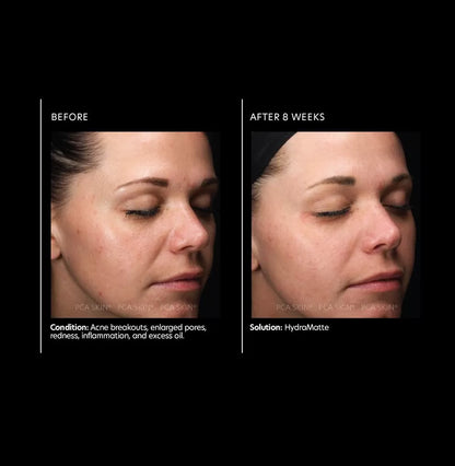 PCA Skin HydraMatte (50 ml)