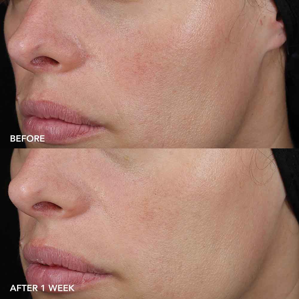 Image skincare  IMAGE MD RAHUSTAV PALSAM 57g