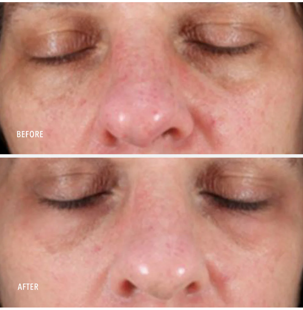 HydroPeptide Collagen Reactivate PM 30ml